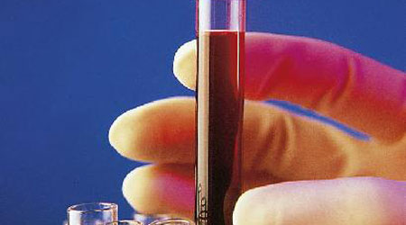 www.mallorcadiario.com  fotos 1 uploads 2012 01 hepatitisc web