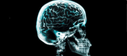 www.mallorcadiario.com  fotos 1 uploads 2012 03 cerebro web