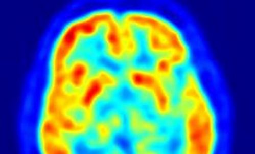 www.mallorcadiario.com  fotos 1 uploads 2012 10 mapa cerebro col2 ok