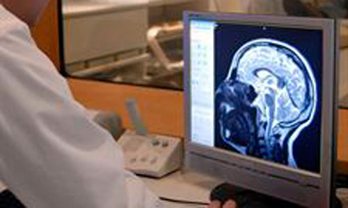 www.mallorcadiario.com  fotos 1 uploads 2012 12 alzheimerok