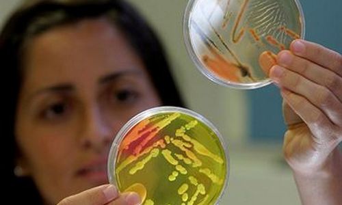 www.mallorcadiario.com  fotos 1 uploads 2012 12 bacterias col2 ok