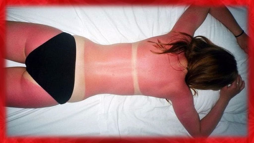 El índice de radiación ultravioleta (UVI) ha aumentado éste sábado