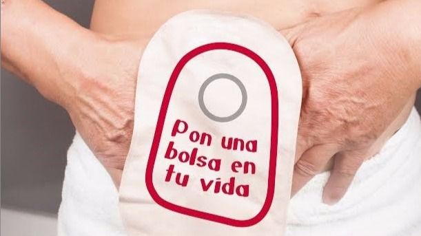 Ostomizadas