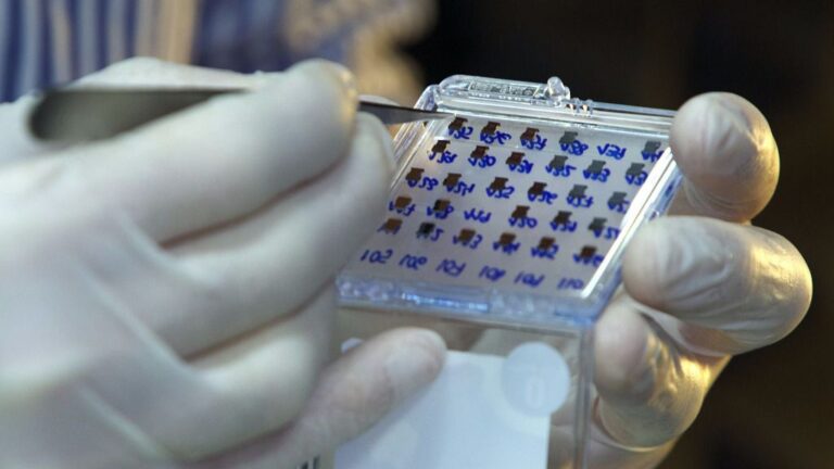 biosensor VIH CSIC ciencia investigación hospital