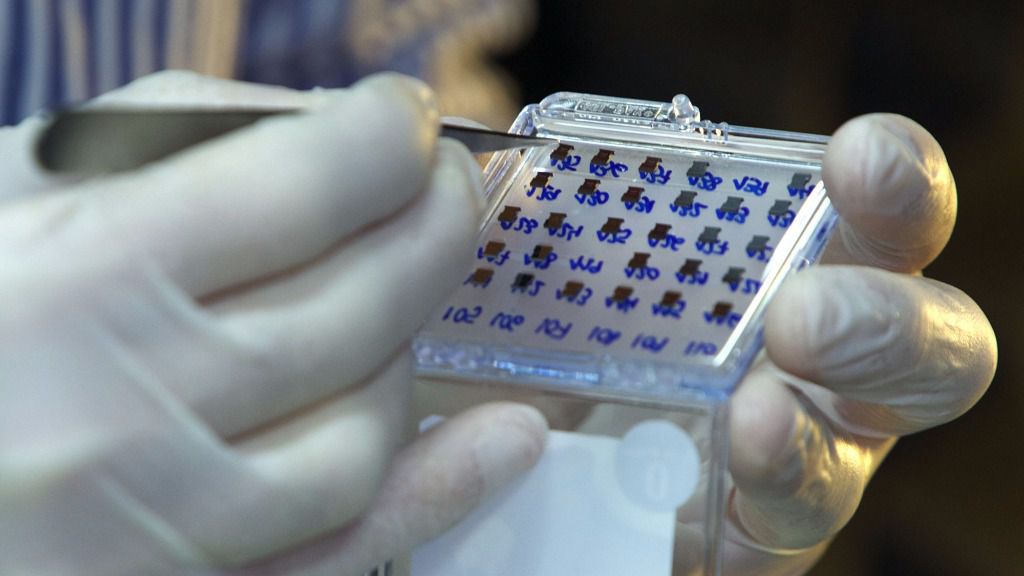 biosensor VIH CSIC ciencia investigación hospital