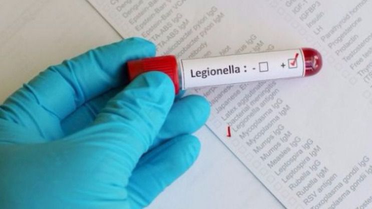 legionela