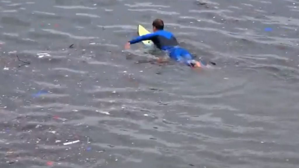 surfero fecal en palma