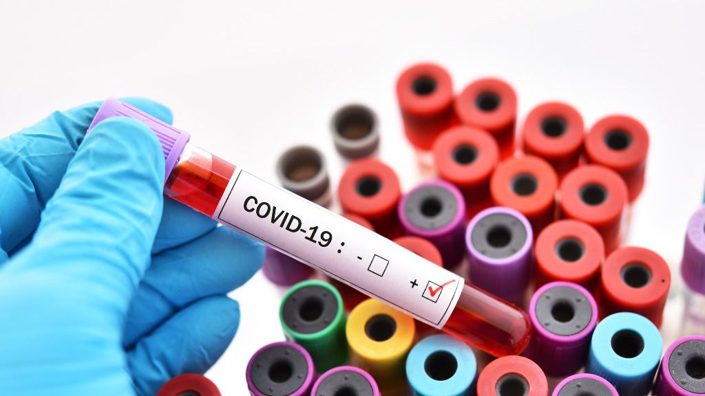 coronavirus