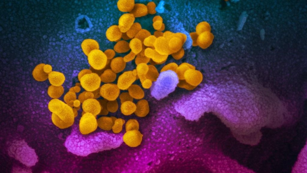 coronavirus