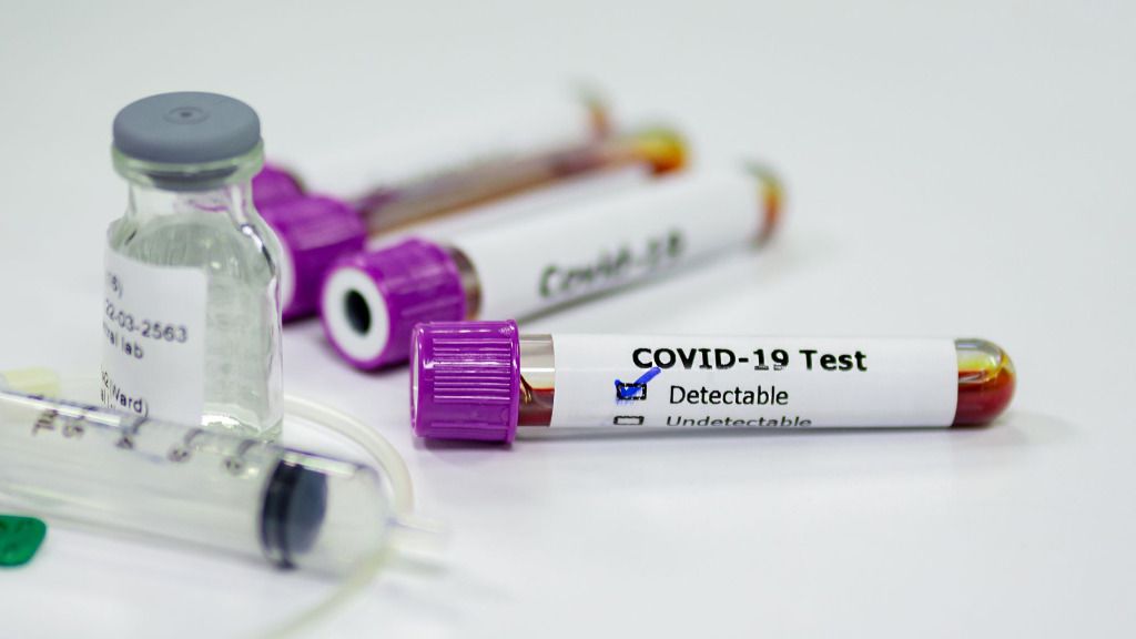 coronavirus