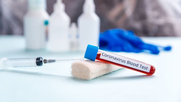 test coronavirus