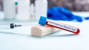 test coronavirus