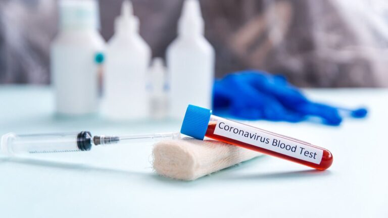 test coronavirus
