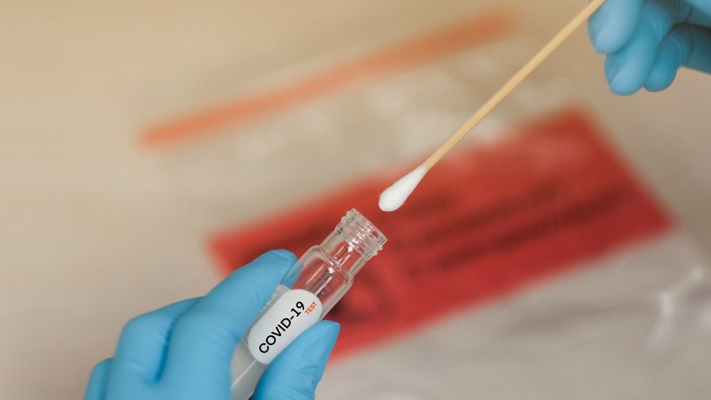 prueba coronavirus