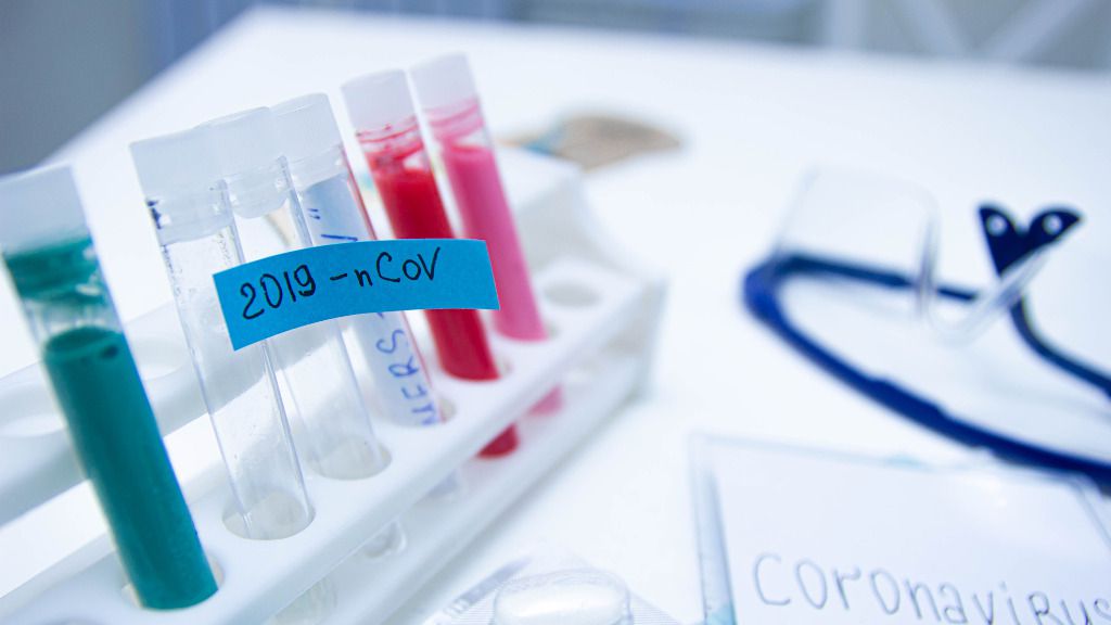 coronavirus laboratorio