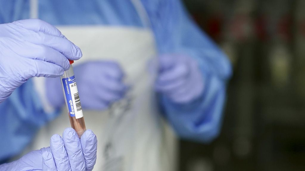 prueba coronavirus