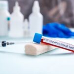 test coronavirus