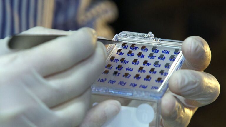 biosensor VIH CSIC ciencia investigación hospital