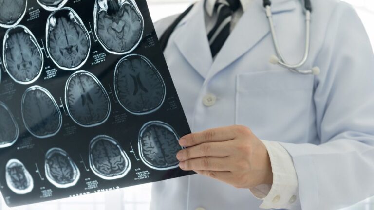 ictus cerebro
