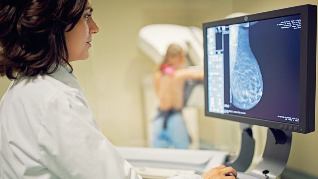 Mamografía cáncer de mama