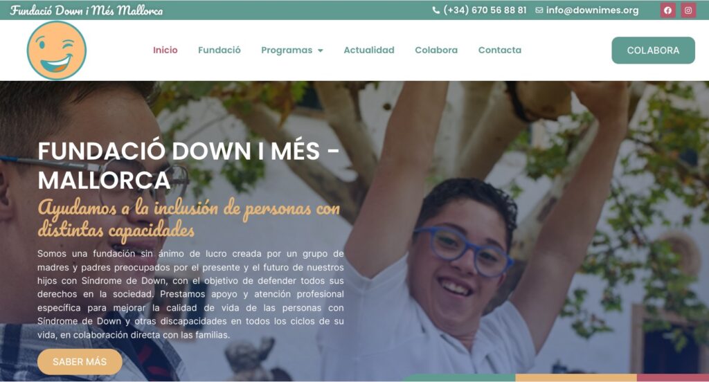 sindrome down
