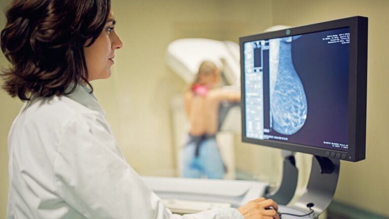 Mamografía cáncer de mama