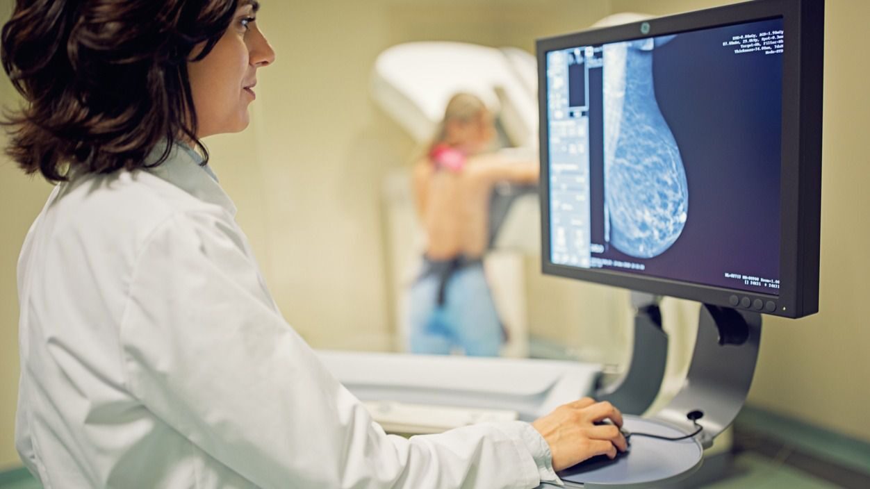 Mamograf&iacute;a c&aacute;ncer de mama