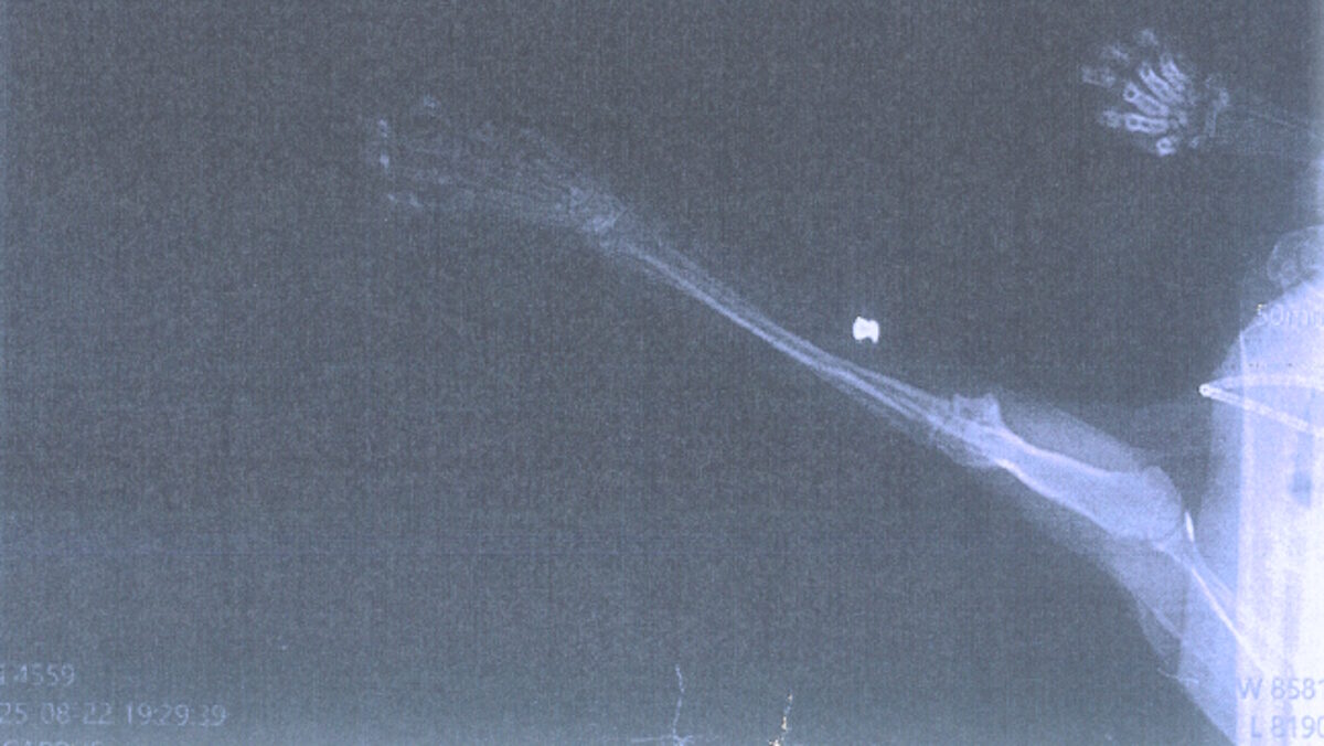 La Policía investiga a un anciano por disparar al gato de su vecina en Palma