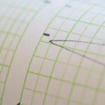 Gr&aacute;fico de medici&oacute;n de un terremoto en un sism&oacute;grafo