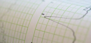 Gr&aacute;fico de medici&oacute;n de un terremoto en un sism&oacute;grafo
